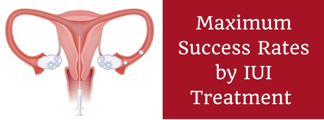 Ucsd Fertility: Personalized Treatment For Success